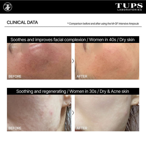 TUPS Pro High Performance M-GF Intensive Ampoule