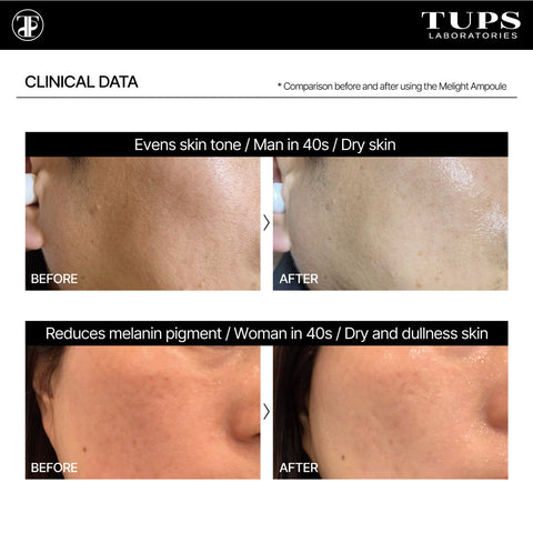 TUPS Pro High Performance Melight Ampoule