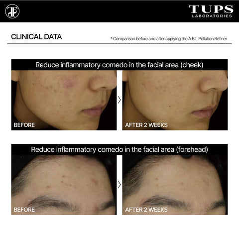 TUPS Pro A.b.l polution refiner ampoule