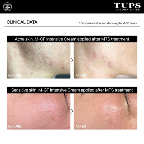 TUPS Pro High Performance M-GF Intensive Cream