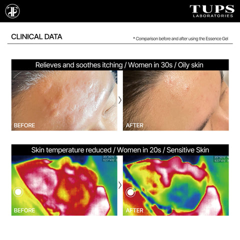 Korean Skin Barrier Focusing TUPS Essence Gel