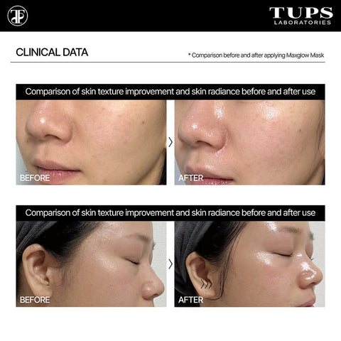 TUPS Pro High Performance Maxglow Mask